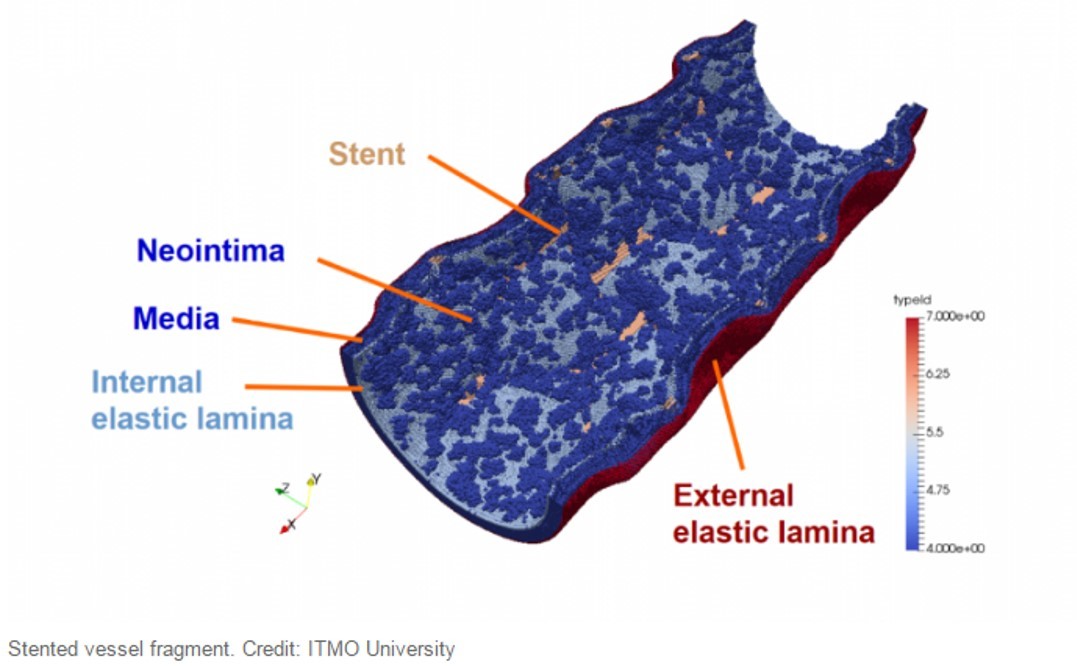 The virtual physiology of the human artery
